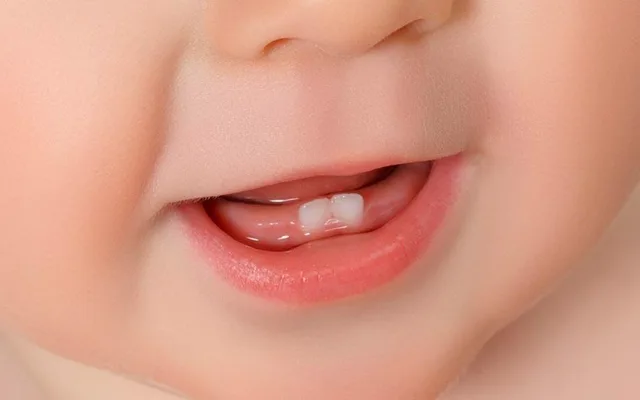 علائم دندان درآوردن نوزاد چیست؟ از آبریزش دهان تا بی‌قراری